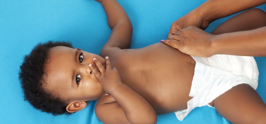 How to treat nappy rash