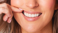 Healthy Teeth Start with Healthy Gums