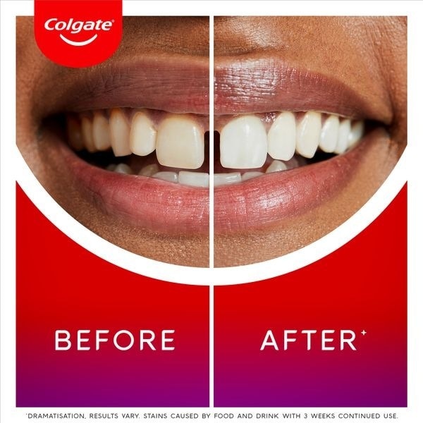 Colgate Max White Ultimate Whitening Toothpaste 75ml