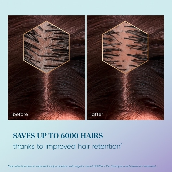HEAD SHOULDERS DENSITY GROW SHMP 300ML