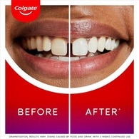 Colgate Max White Ultimate Whitening Toothpaste 75ml