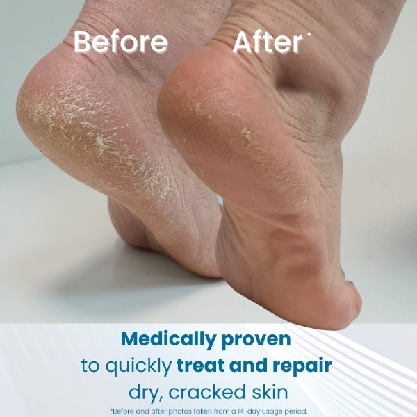 Flexitol Heel Balm 56g