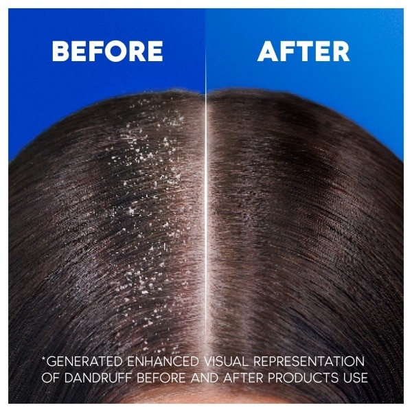 Head and Shoulders Supreme Moisture Shampoo 250ml
