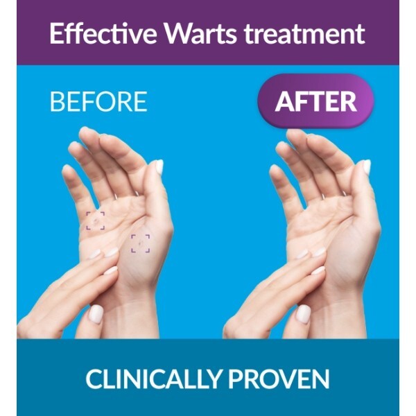 Excilor Warts Treatment Gel 4ml